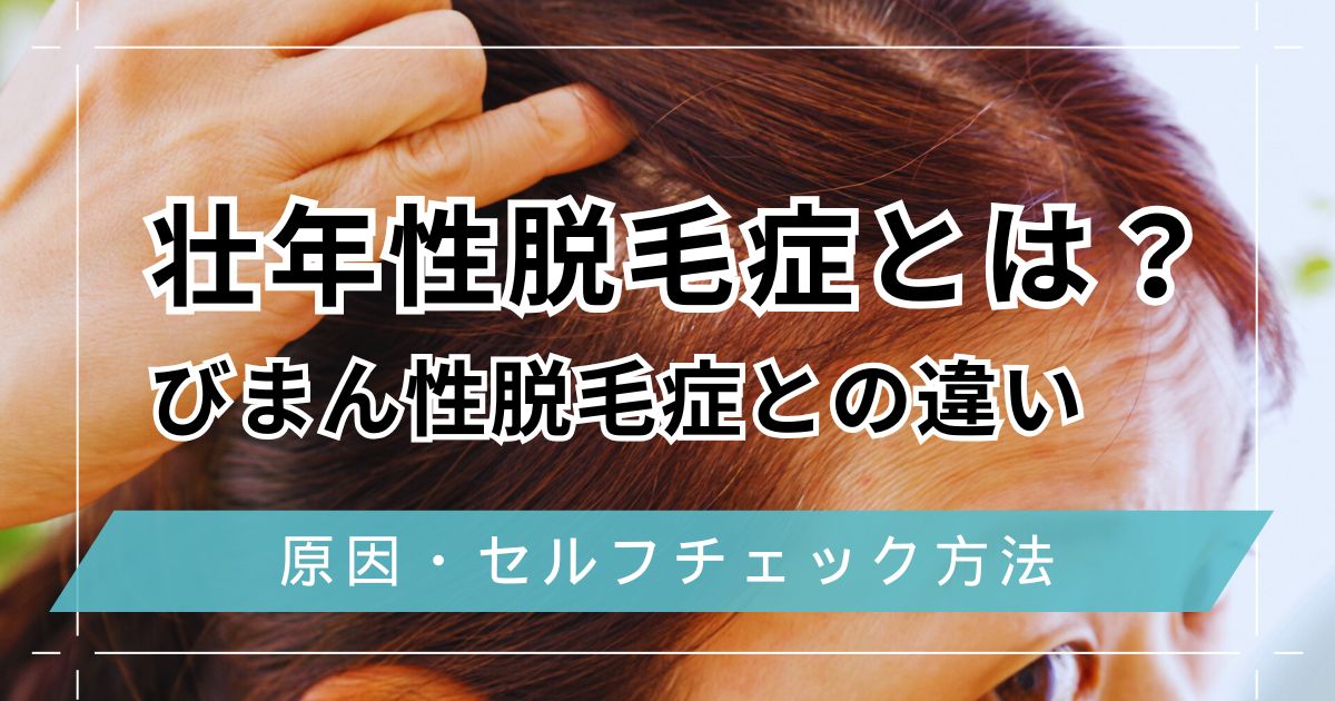 壮年性脱毛症とは？びまん性脱毛症との違いや原因・男性女性別のセルフチェック方法