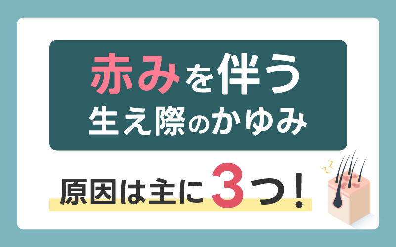 赤みを伴う生え際のかゆみの原因は主に3つ