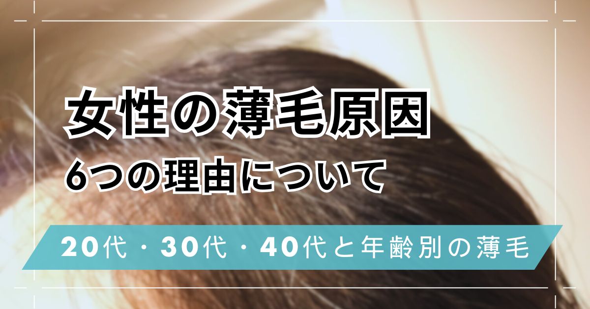 女性の薄毛原因は主に6つ！20代・30代・40代と年齢ごとの薄毛対策方法
