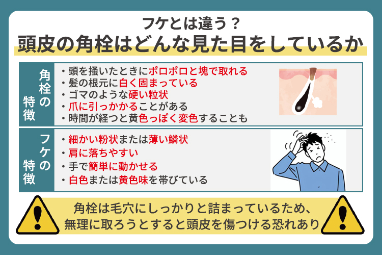 フケとは違う？頭皮の角栓はどんな見た目をしているか