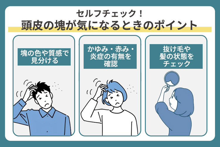セルフチェック！頭皮の塊が気になるときのポイント