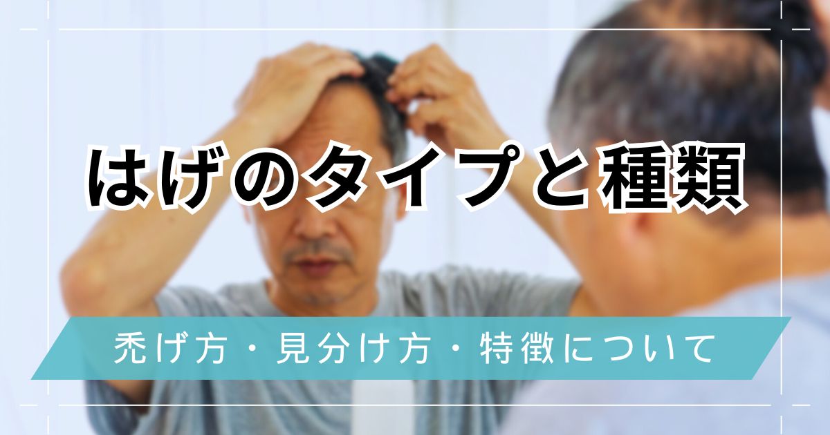 はげのタイプと種類！禿げ方・見分け方・特徴を解説