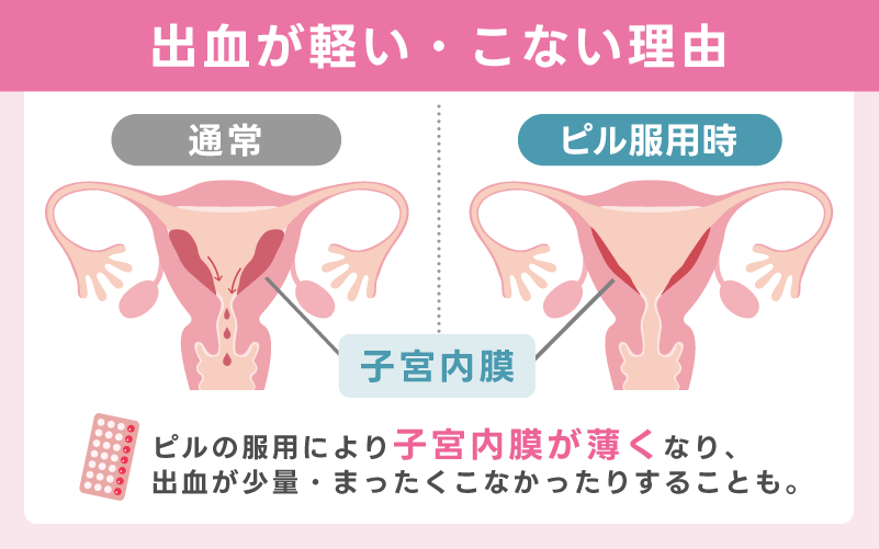 出血が軽くなる・こないこともある理由