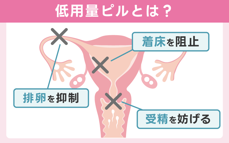 低用量ピルとは？基礎知識をわかりやすく解説