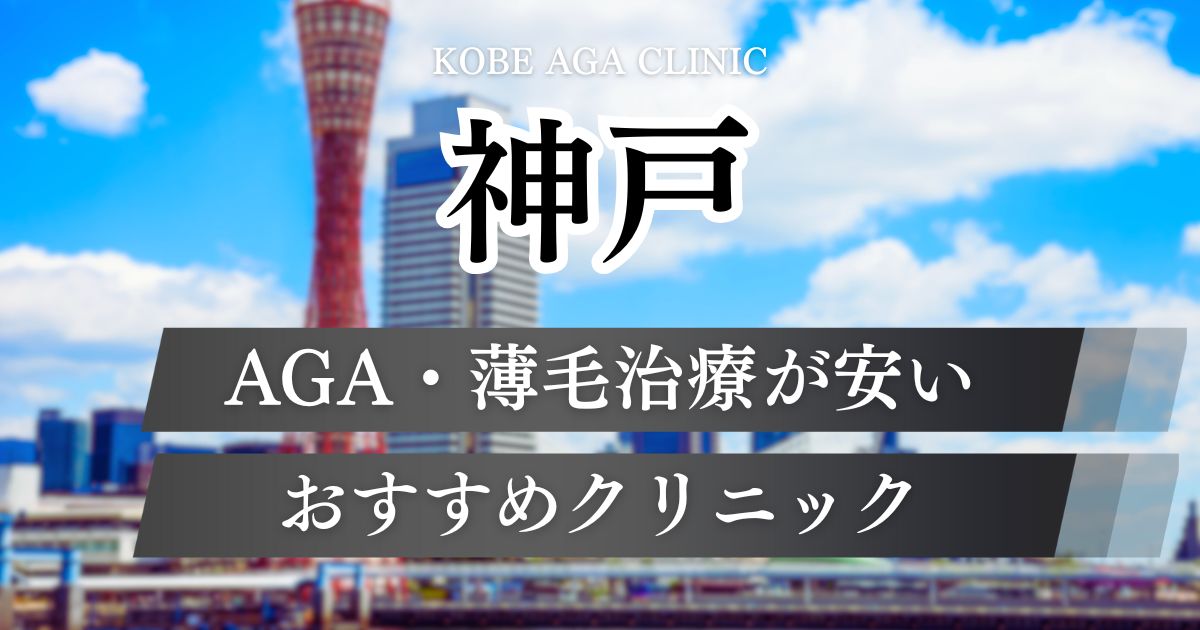 神戸でAGA治療が安いおすすめクリニック14院！神戸駅・三宮エリア