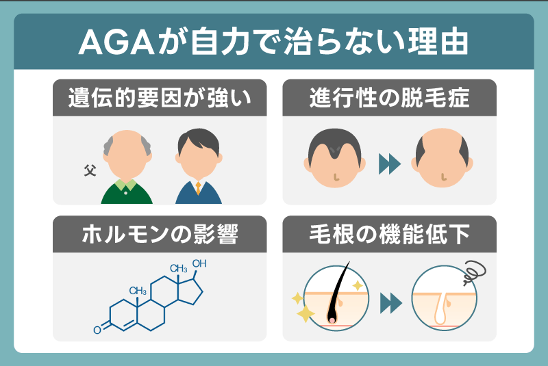 AGAが原因なら自力で治らない