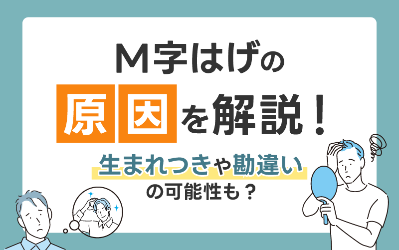 M字はげの原因を解説！生まれつきや勘違いの可能性も