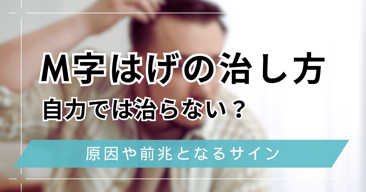M字はげの治し方！自力で治らない？手遅れになる前に前兆や原因を解説