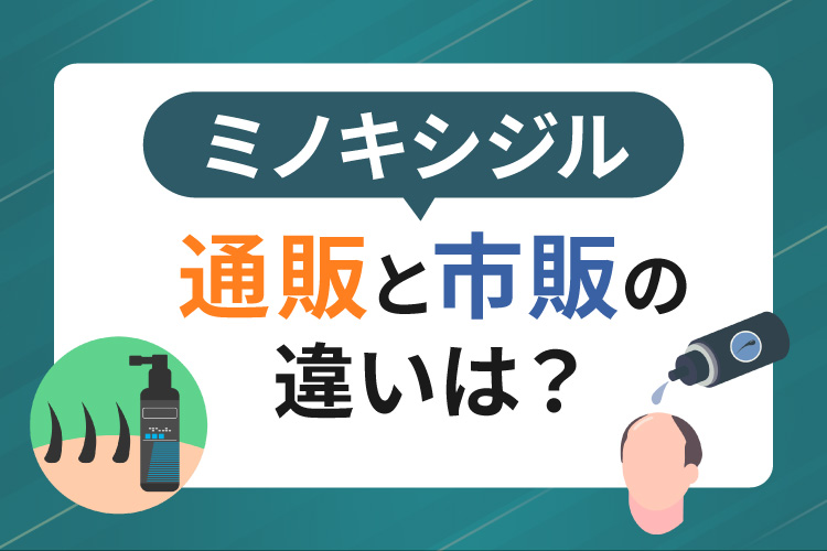ミノキシジル通販と市販の違い