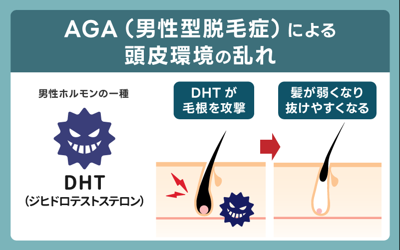 AGA（男性型脱毛症）による頭皮環境の乱れ