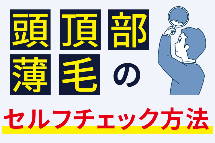 つむじはげのセルフチェック法