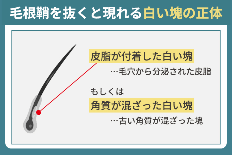 毛根鞘を抜くと現れる白い塊の正体