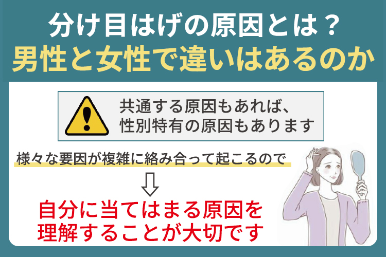分け目はげの原因とは？男性と女性で違いはあるのか