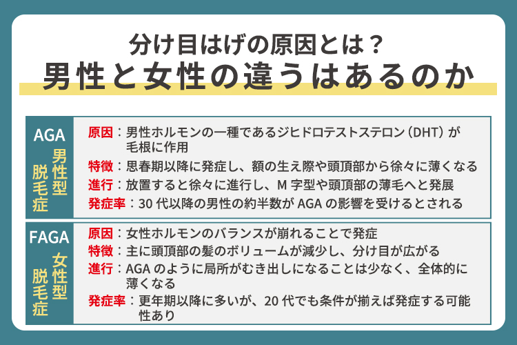 男性はAGA女性はFAGAの可能性