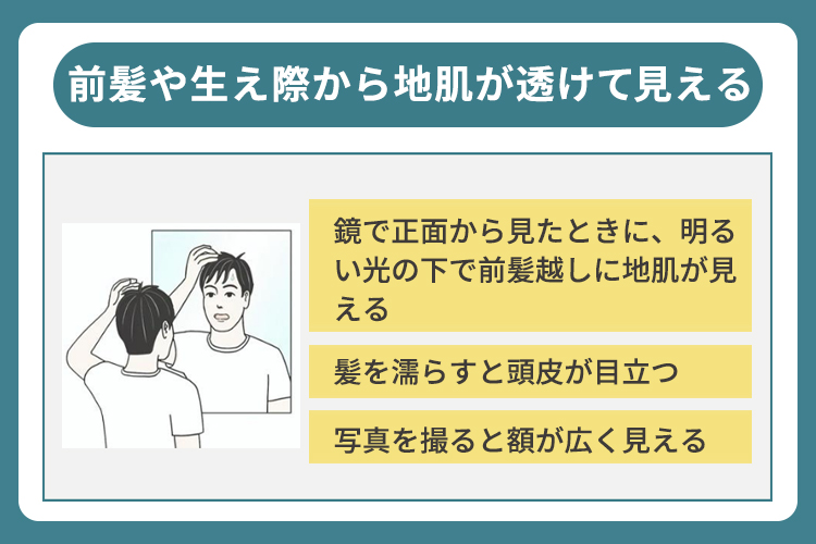 前髪や生え際から地肌が透けて見える