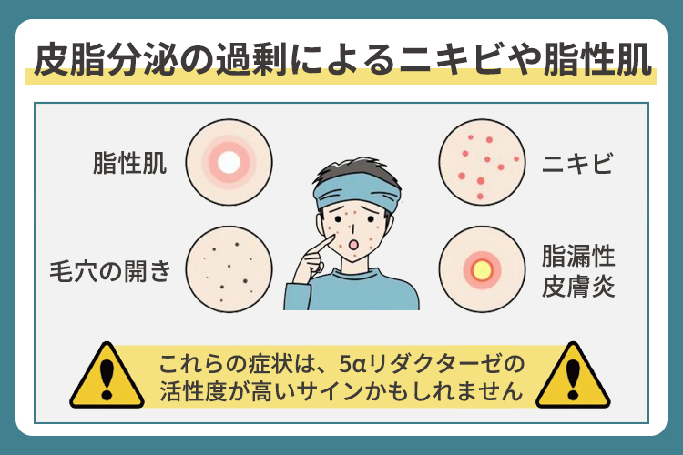 皮脂分泌の過剰によるニキビや脂性肌