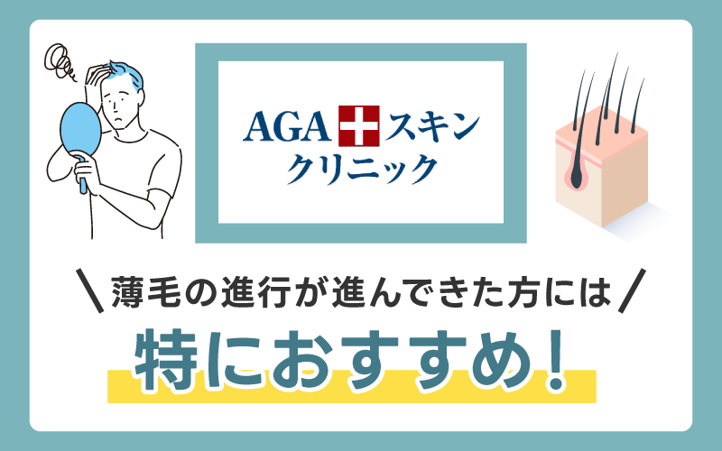 AGAスキンクリニックは薄毛の進行が進んできた方には特におすすめ