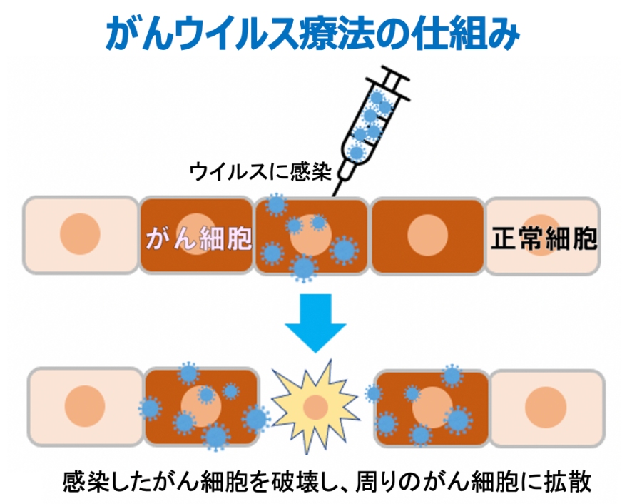がんウイルス療法の仕組みを表した図